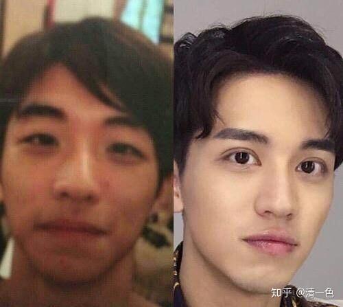 明星整容对比照，整容的女明星失败(整容成功的女明星对比照)