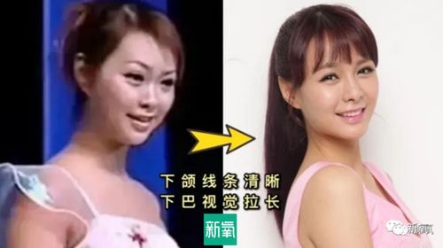 沈梦辰整容对比，杜海涛(杜海涛和沈梦辰身高对比)