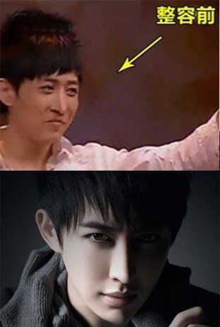 王亦丰整容前，baby整容前的图