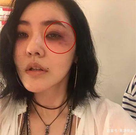 小s疑遭家暴，家暴离婚(小s女儿家暴)