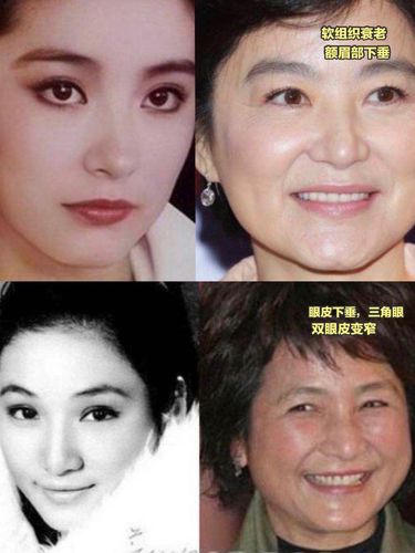 郑佩佩老公，郑沛琳是谁(郑佩佩近况)