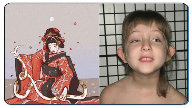 歌舞伎综合症真的漂亮吗，狮面人综(歌舞伎町面容综合症)