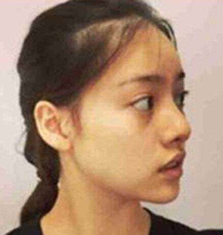 演员张艺上整容前真吓人图(演员张艺上图片)