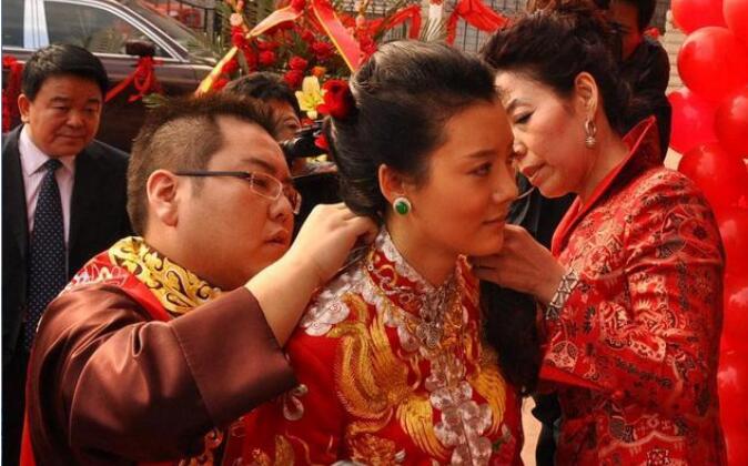 车晓的鼻子怎么回事是朝天鼻吗(车晓的鼻子变好看了)