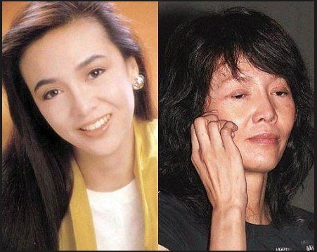 超女王贝整容意外身亡真相(超女王贝贝整容死亡)