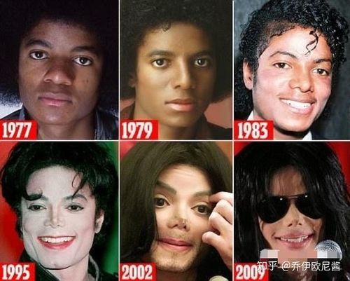 杰克逊的鼻子，MJ上确实活着(迈克杰克逊的鼻子为什么很怪)