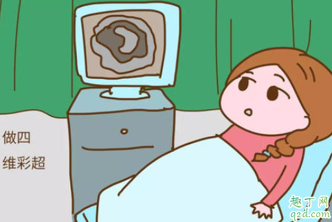 查四维孩子喜欢趴着是男是女(四维彩超孩子趴着是男孩女孩)