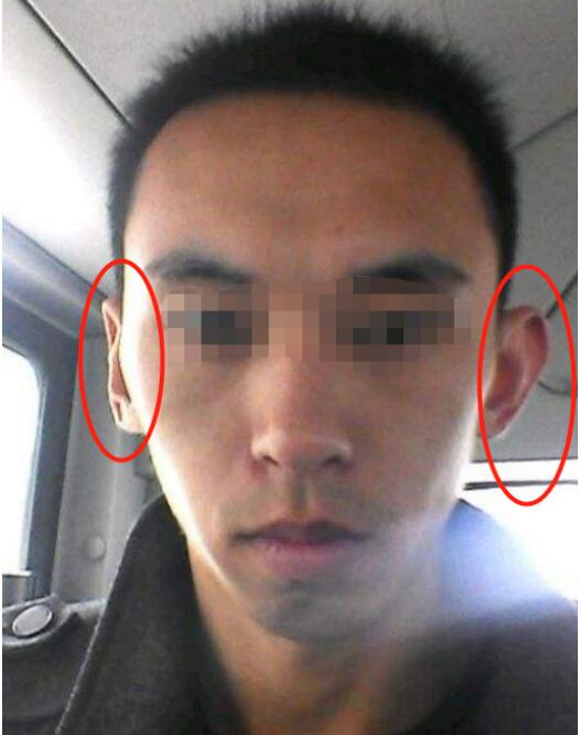 耳朵不对称必成大器真的假的,耳朵小又薄是不是不好？　本文共（823字）