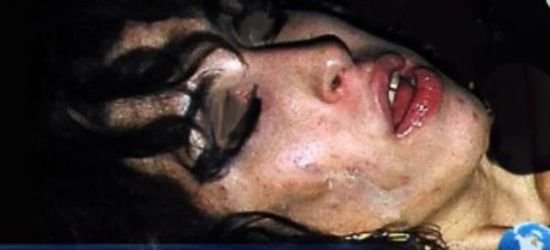 艾米怀恩豪斯烂脸的图片,她死后老公现状如何？　本文共（991字）