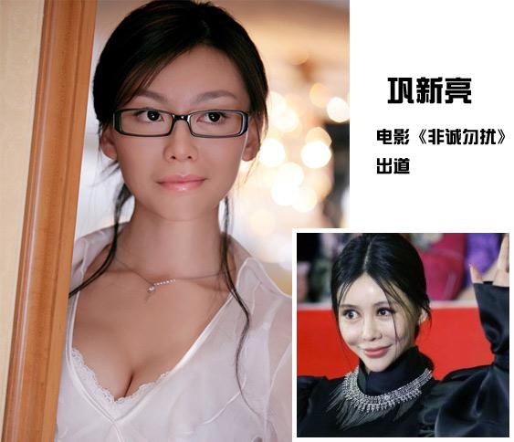 明星整容失败惨不忍睹 揭秘十位明星整容前后对比　本文共（2099字）