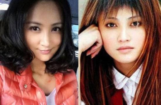 明星整容失败惨不忍睹 揭秘十位明星整容前后对比　本文共（2099字）