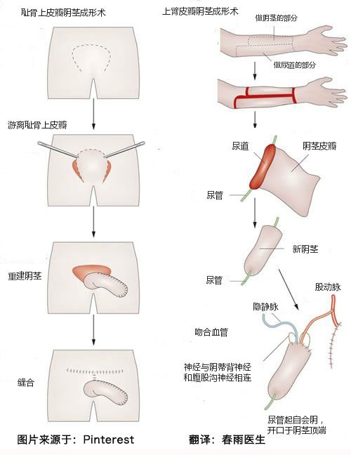 女变男真的可以当男人吗,世界上女变男的变性人真实照片　本文共（1203字）