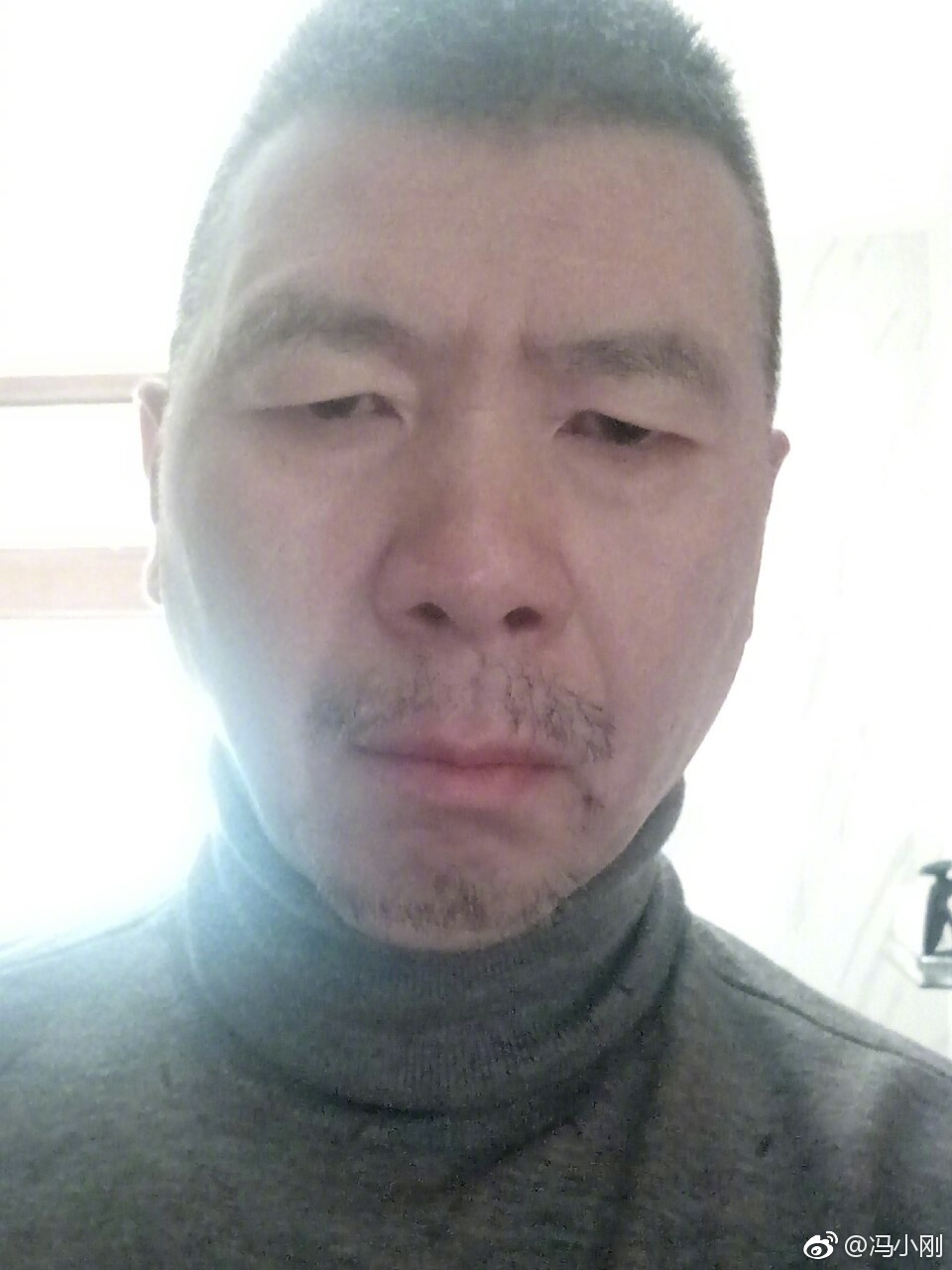 冯小刚白斑病自愈了真的吗？他白斑病最新的照片曝光　本文共（1074字）