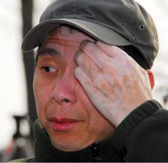冯小刚白斑病自愈了真的吗？他白斑病最新的照片曝光　本文共（1074字）