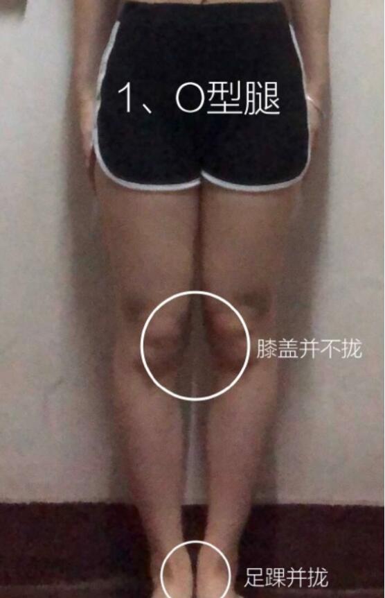 日本人o型腿比例多大,日本姑娘o型腿照片　本文共（1046字）