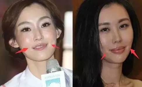 微整老了以后真可怕图片,整容医生都不整容是真的吗？　本文共（1089字）