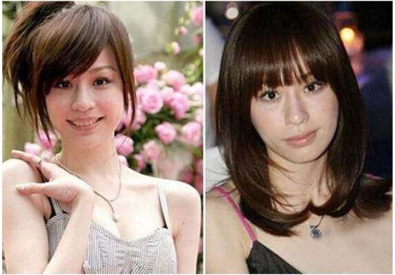 整容后的女明星个个脸僵硬图,整容脸为什么会显得僵硬？　本文共（1192字）