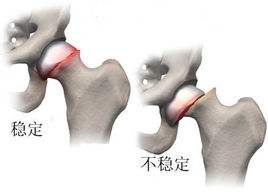 正骨是什么原理,正骨发出响声是复位了吗为什么很舒服　本文共（956字）