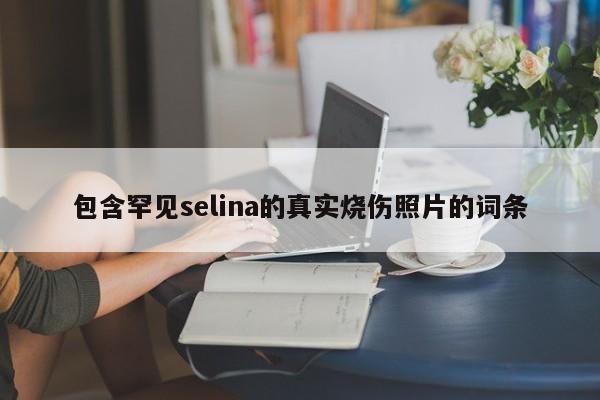 包含罕见selina的真实烧伤照片的词条 