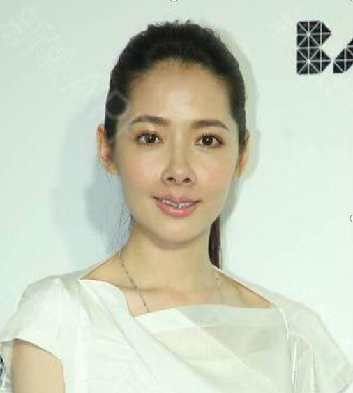 郭碧婷嘴巴歪的吗