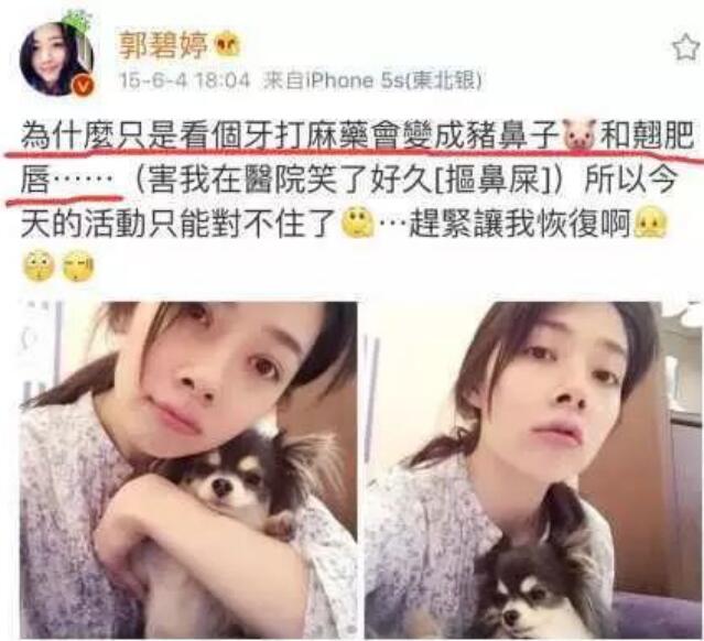 郭碧婷嘴巴歪的吗