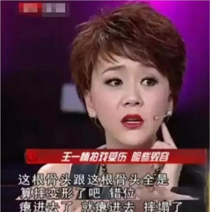 王一楠毁容以前长啥样子(王一楠现在的样子)