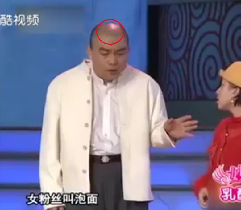 程野光头是剃的还是脱发(光头剃了还会长发吗)