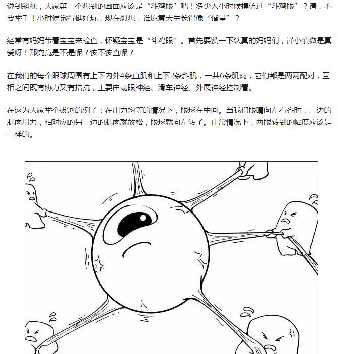 朱俐静是不是斗鸡眼