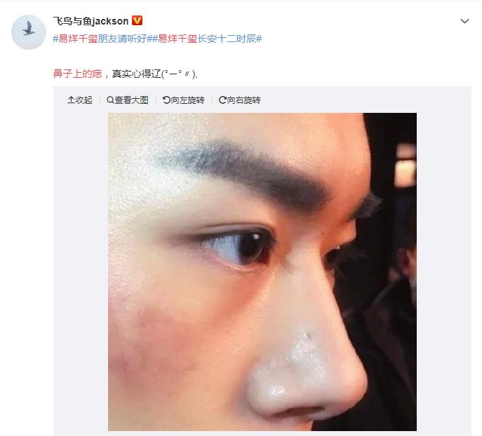 易烊千玺鼻子怎么变高的(易烊千玺整鼻子)