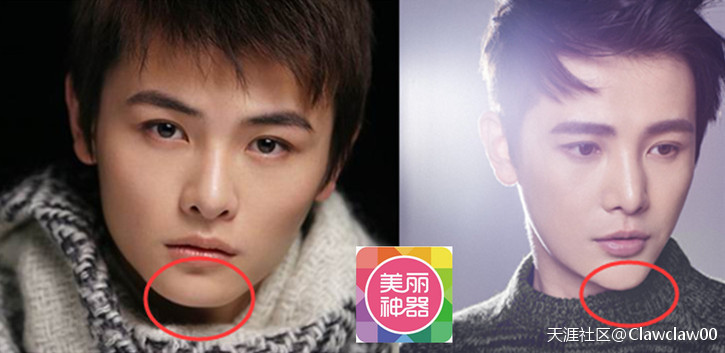 孙坚整容前后对比照片(孙坚以前的照片)