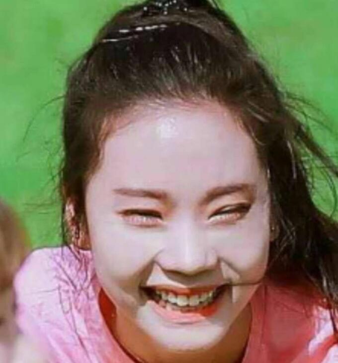张紫宁的下巴胎记是什么